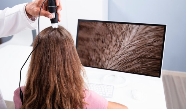 Technology Advancements in Hair Loss Solutions