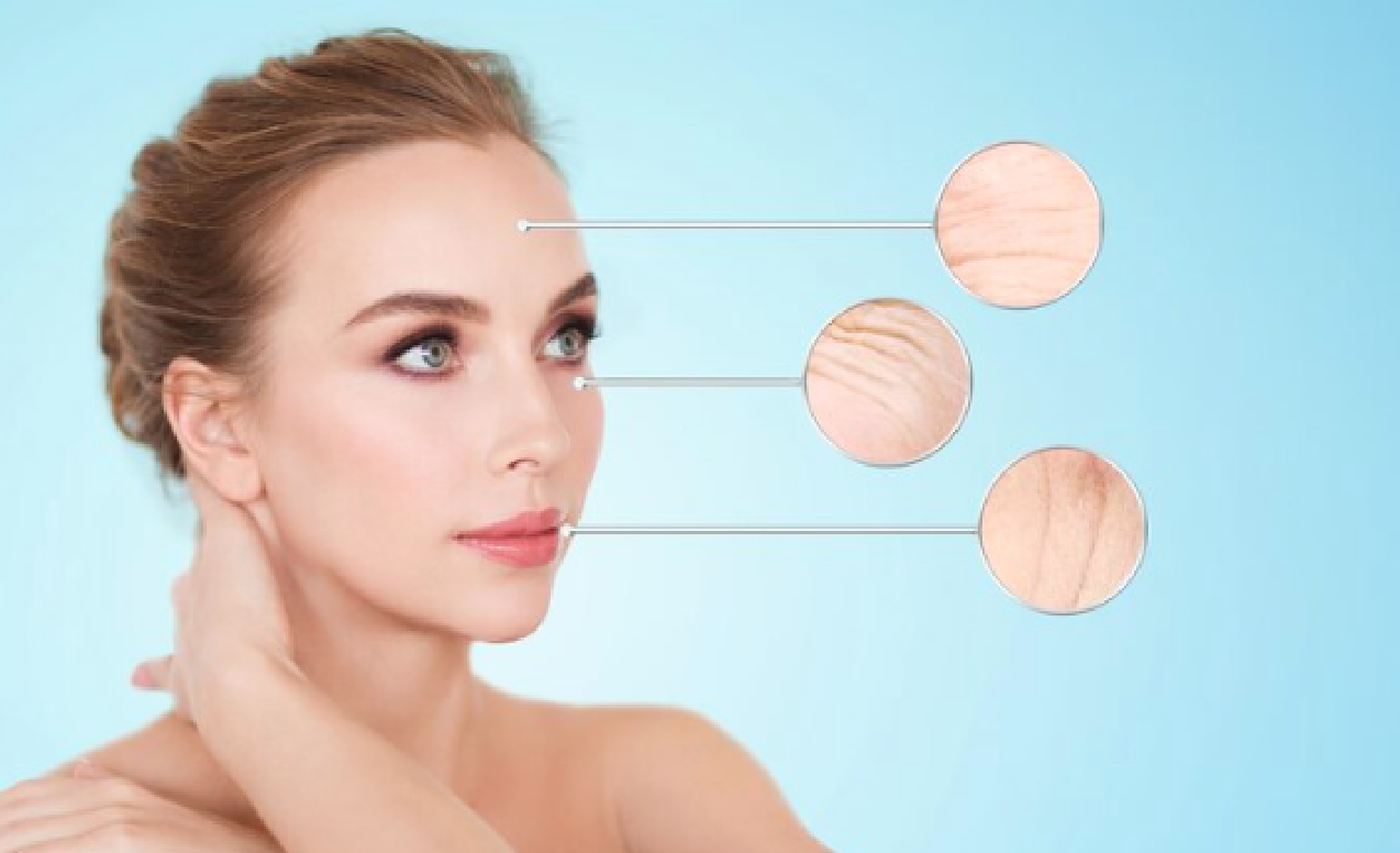 Natural Ways to Minimize Wrinkles Without Surgery Achieve Youthful Skin Naturally