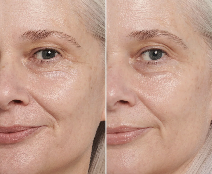 Choosing a Product for Your Skin Type